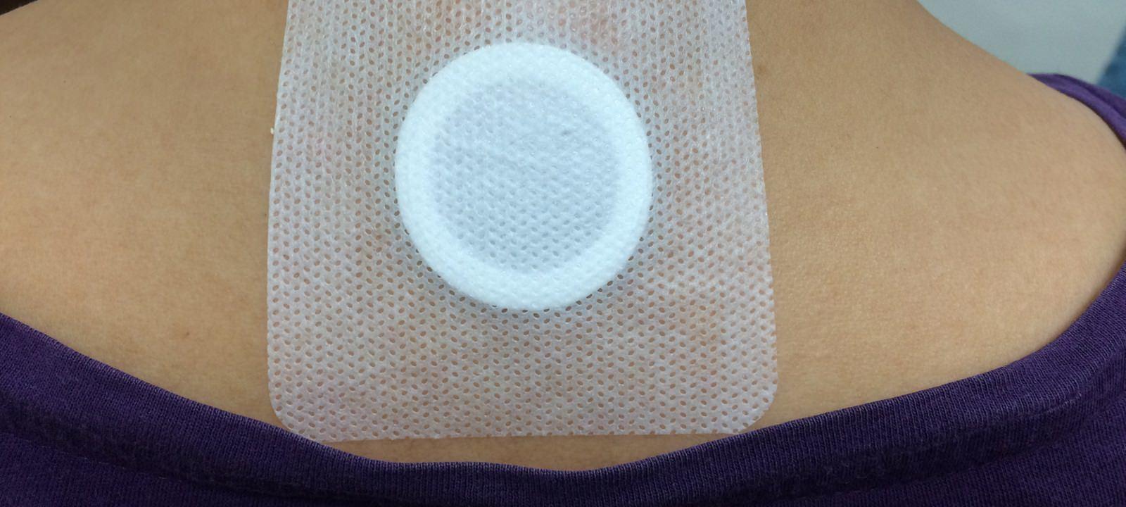 三伏天灸, 三九天灸, 鼻敏感 中醫